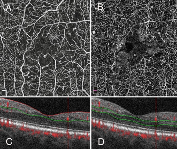 figure 20