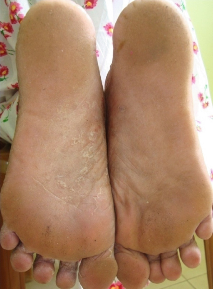 nylon soles feet at central park in ny