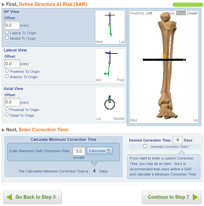 2/3 Ring Fixator For Tibial & Femur Fracture - Orthopedic Drills