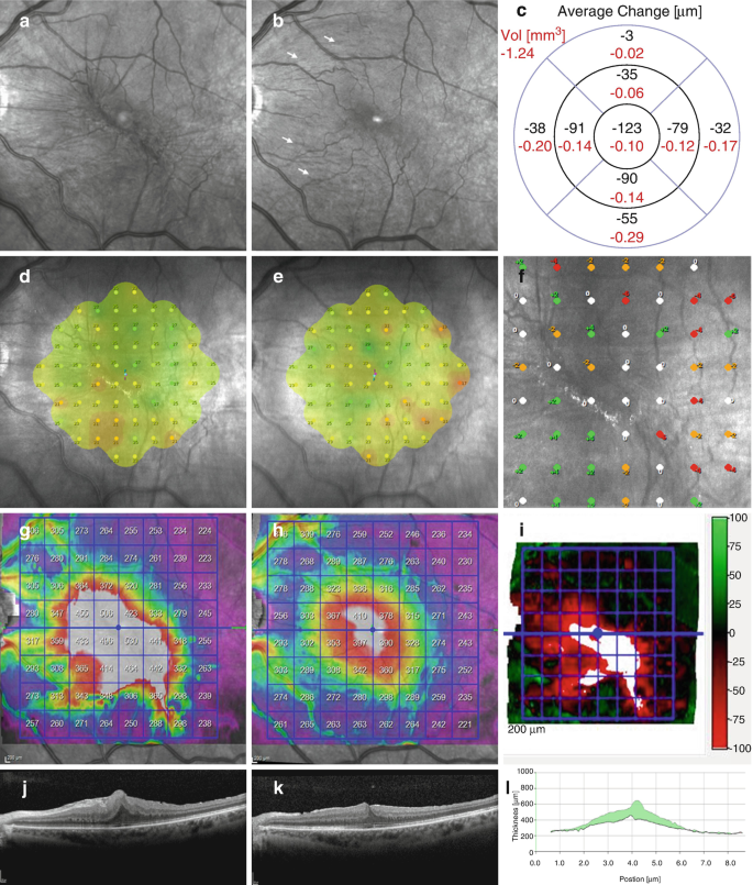 Amsler test grid. Eye scotoma chart. Oculist Vector printable