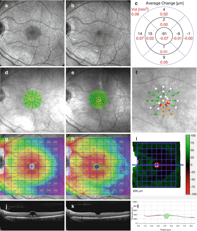 Amsler test grid. Eye scotoma chart. Oculist Vector printable