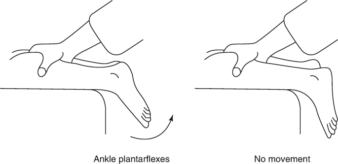 figure 34