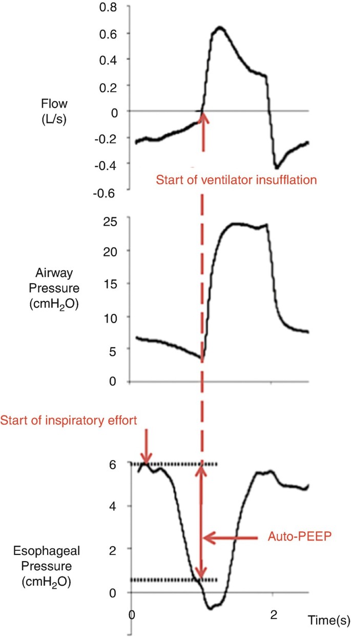 FIGURE. Diagnosis and treatment in 284 consecutive patients with