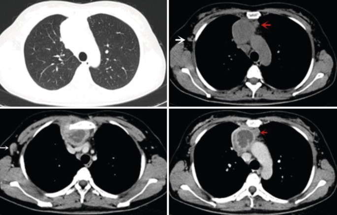 figure 15