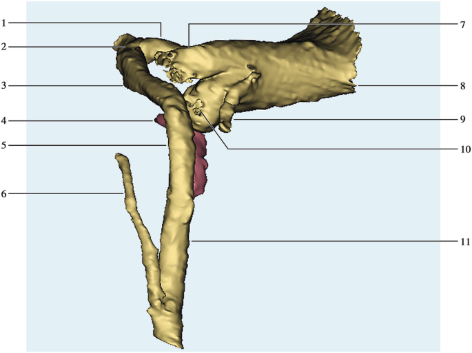 Three Dimensional Reconstruction Of Temporal Bone Springerlink