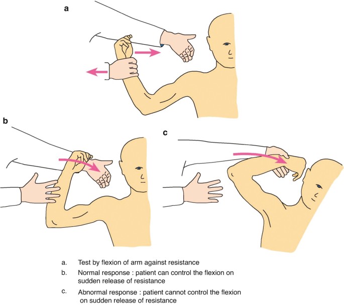 Lower Limb Neurological Examination - OSCE Guide | Geeky Medics