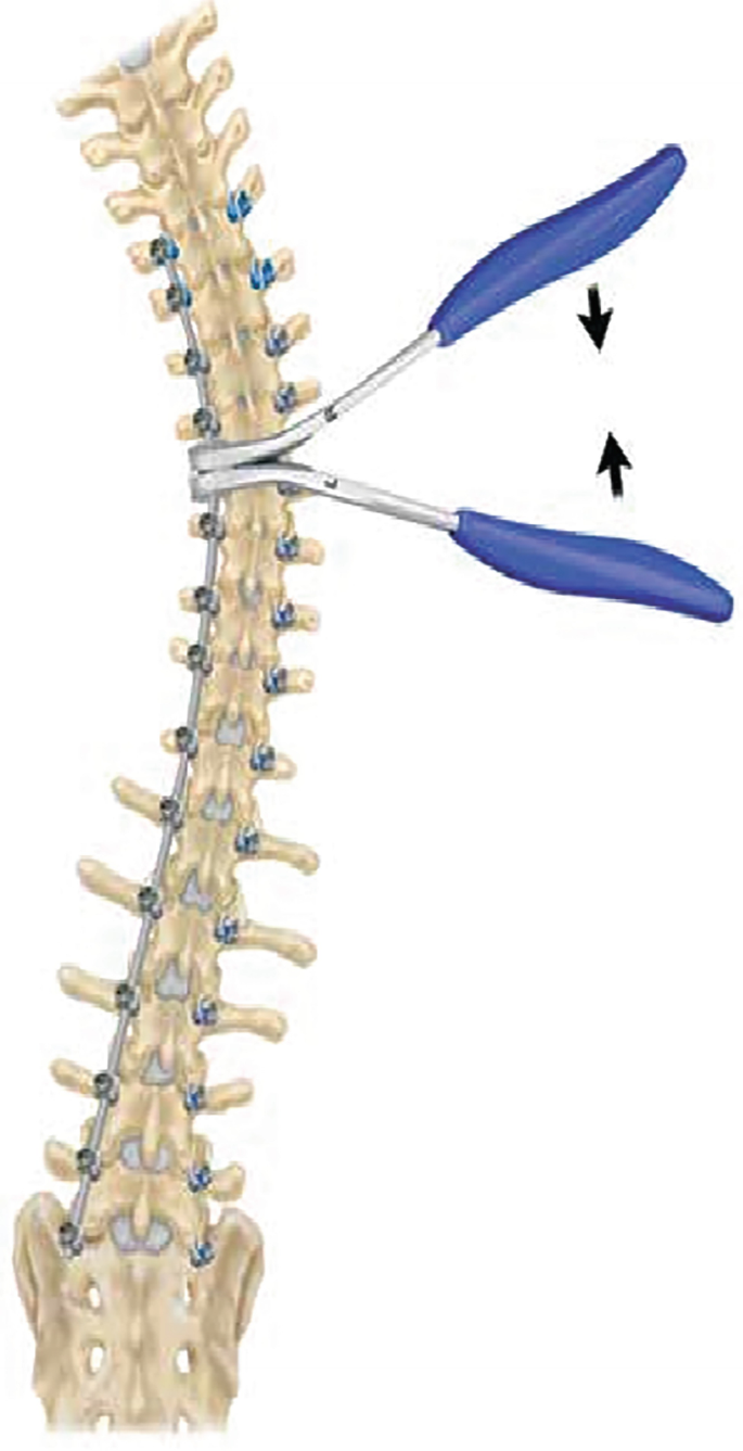 figure 41