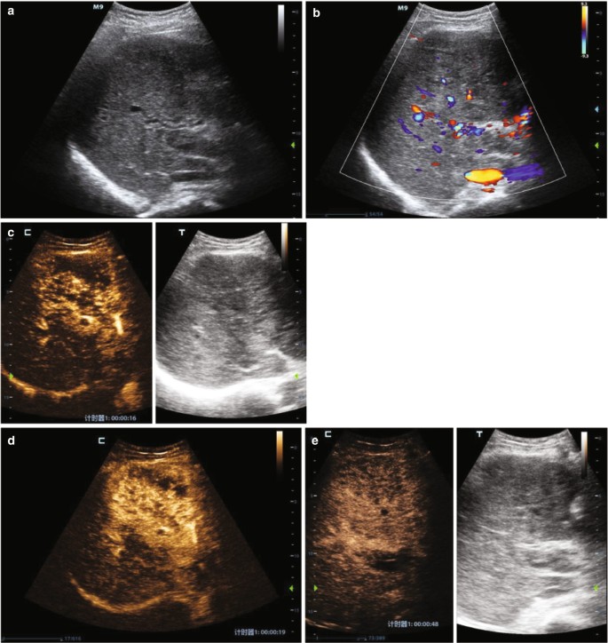 figure 15