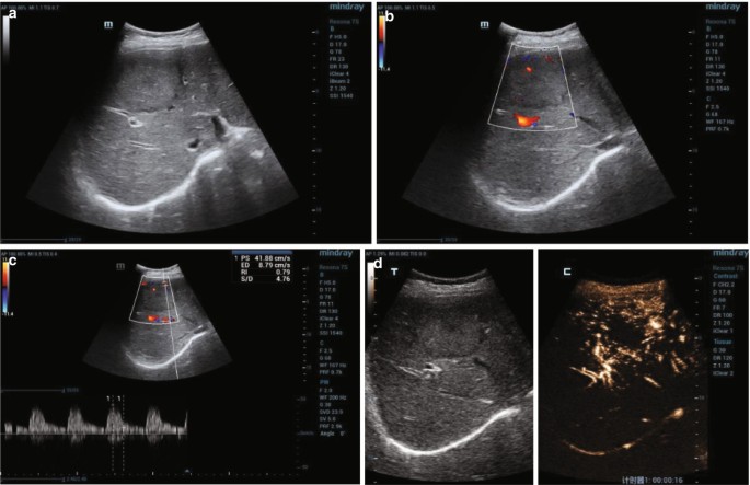 figure 38