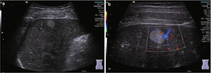 figure 23