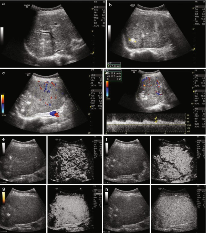 figure 24