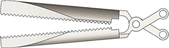 Challenges in the Design of a Laparoscopic Surgical Forceps