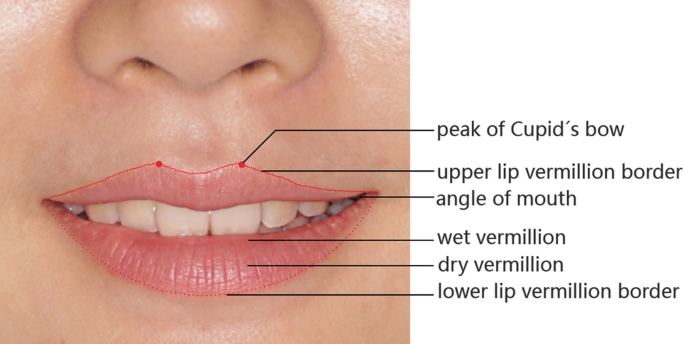 Pearl – Semiology – Upper Lip – Cupid's Bow – Clinical Eye Openers