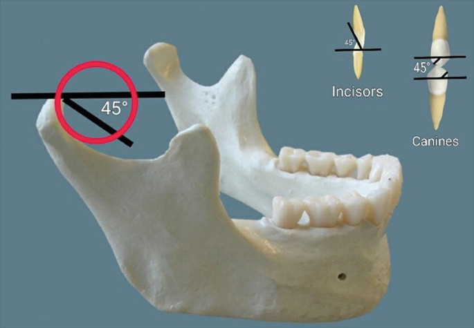 Essential requirements of a non-occlusal mandibu- lar reference position