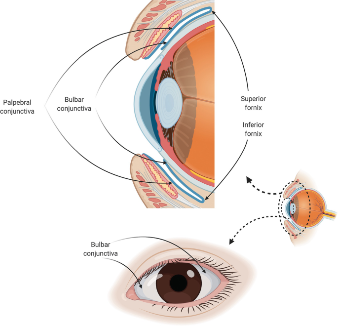 follicular conjunctivitis histology