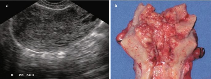 figure 36