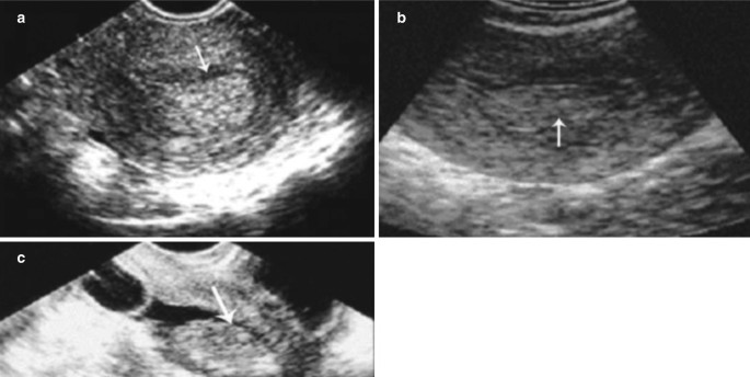 figure 42