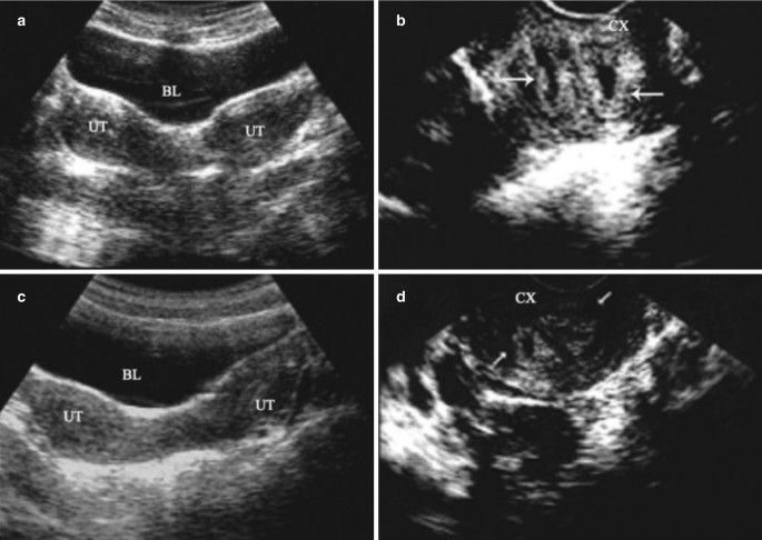 figure 58