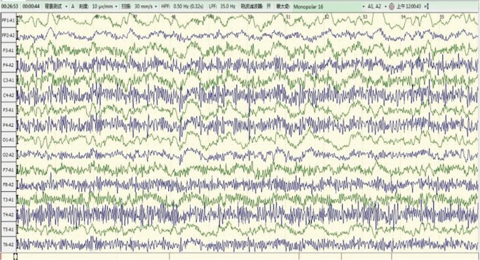 figure 15