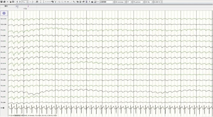 figure 22