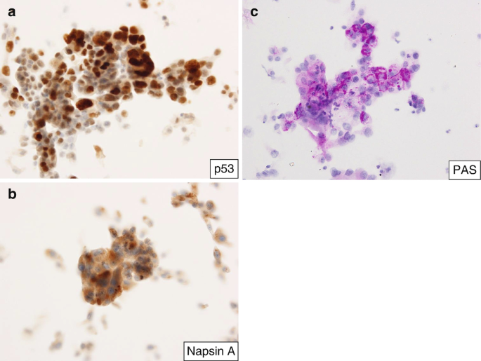 figure 42