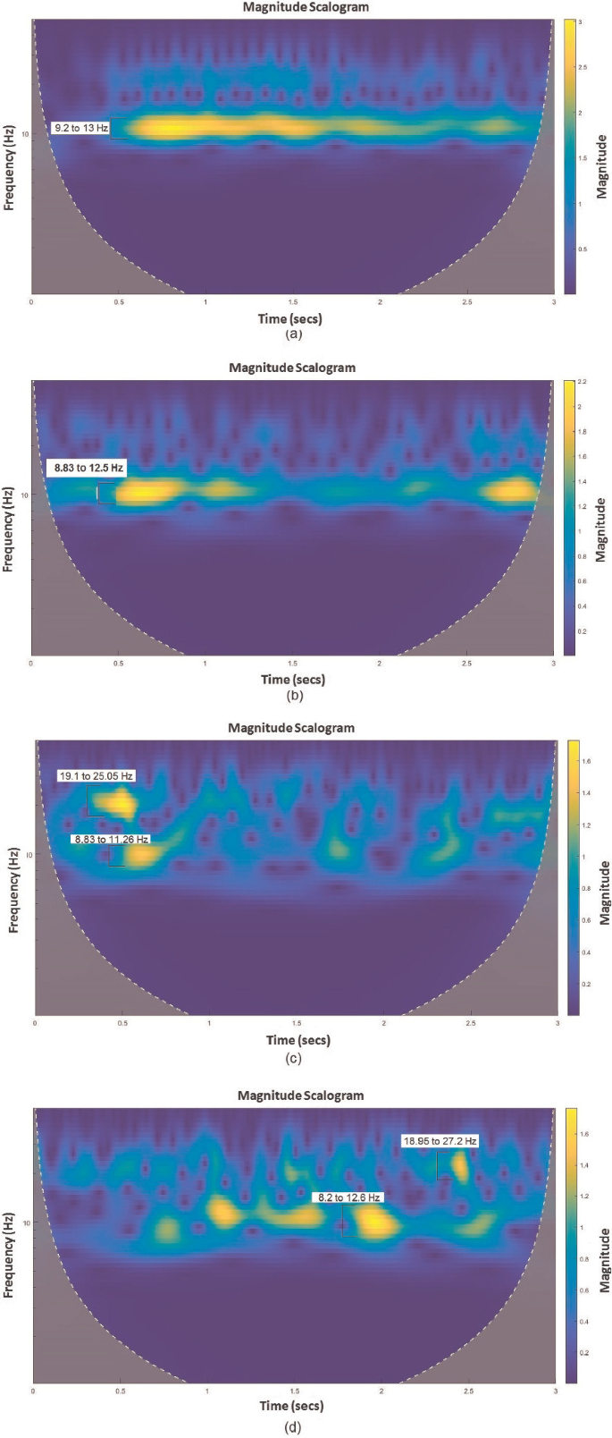 Feature Extraction Techniques for the Classification of Four-Class Motor  Imagery Based EEG Data: A Comparison | SpringerLink