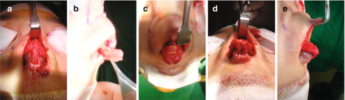 figure 28