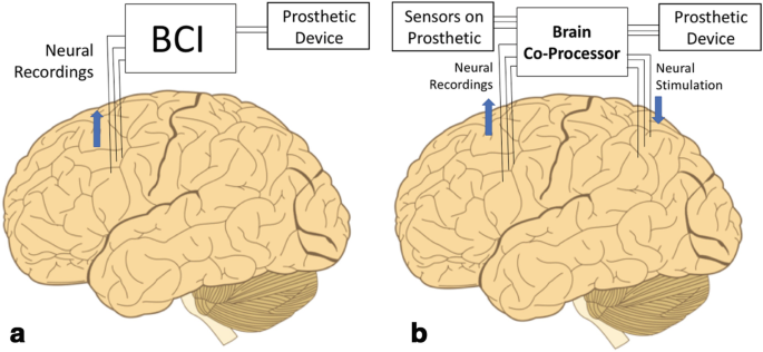 Algorithm may improve brain-controlled prostheses and exoskeletons