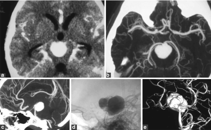 figure 15