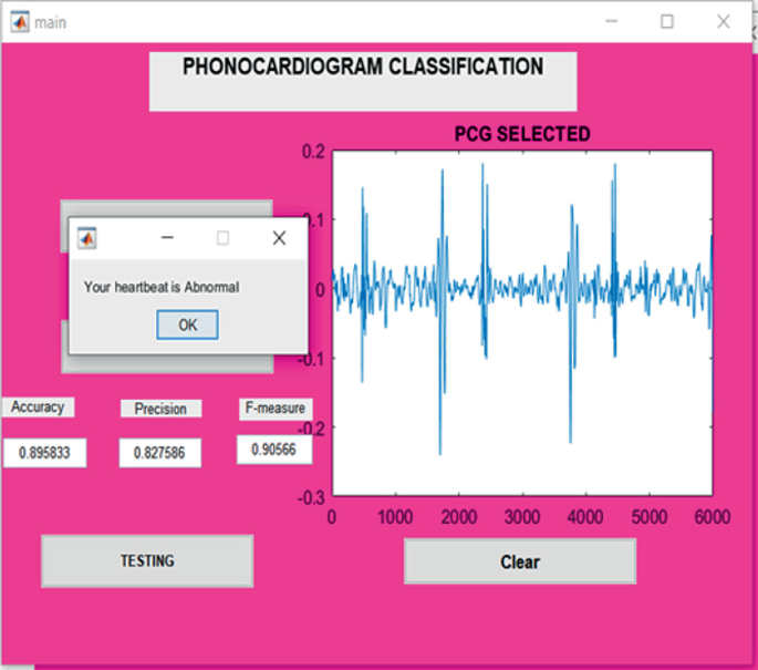 phonocardiogram microphone clipart