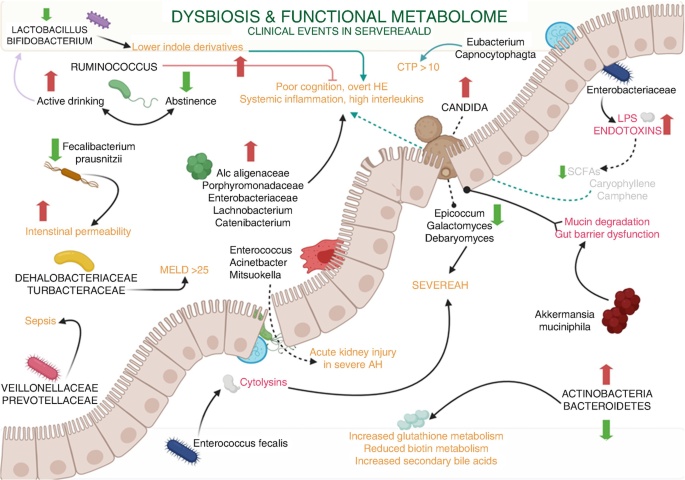 Gut Microbiota-Related Clinical Events and Therapeutic Interventions in  Alcohol-Associated Liver Disease
