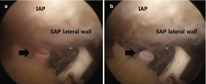 figure 22