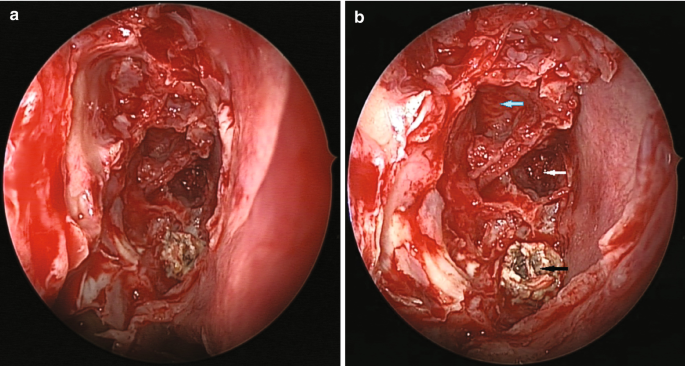 figure 66