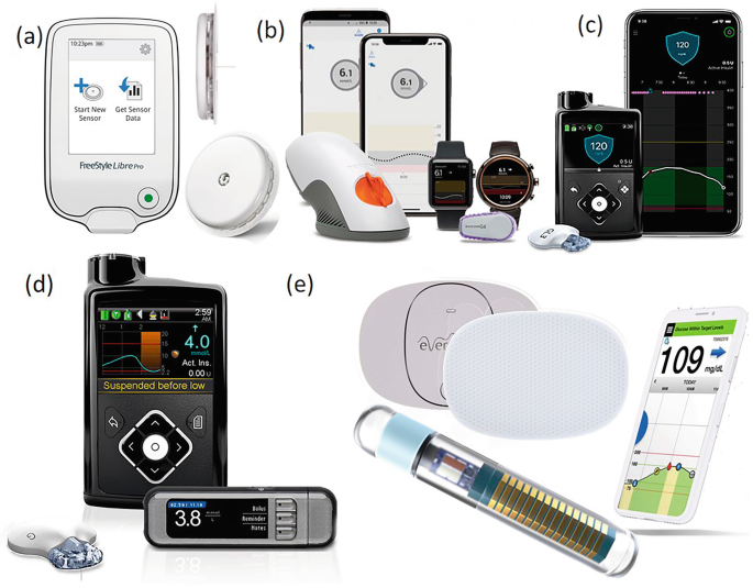 Continuous Glucose Monitoring For Diabetes Management Based On Miniaturized Biosensors Springerlink