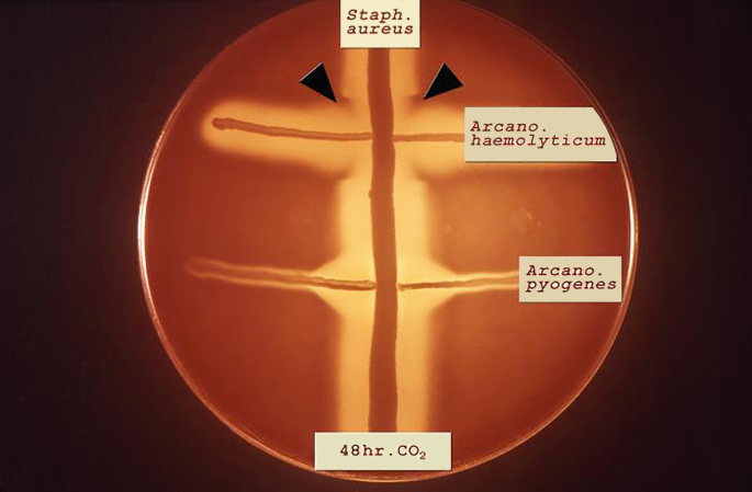 CAMP test and Reverse CAMP test – Microbiology and Infectious Diseases