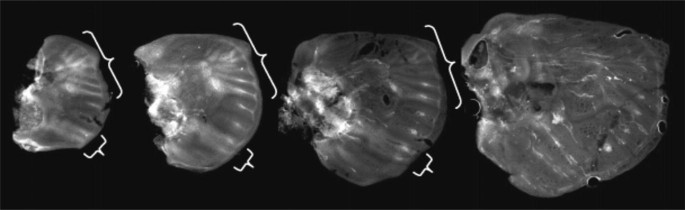 An image with 4 left wings of a Nymphalid butterfly in 4 stages. The bracket indicates the genetic expression on the wings.