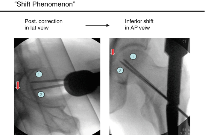 figure 37