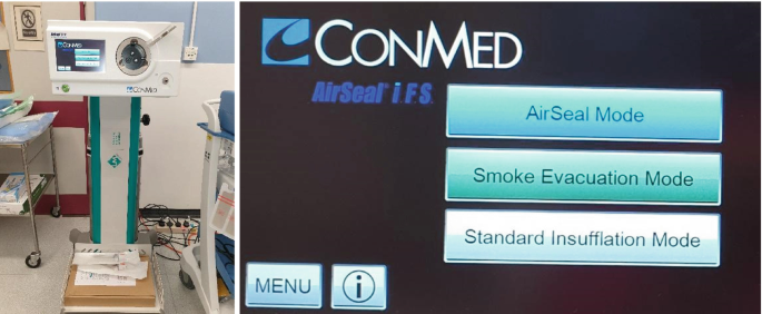 A set of images. Image A depicts a machine in the centre of a room, with a large L C D screen on the right and a large port on the left. Image B represents the menu found on the machine's L C D screen. Labels from top to bottom, Air Seal Mode, and Smoke Evaluation Mode. The menu reads Standard Insufflation Mode on the lower left, and i.