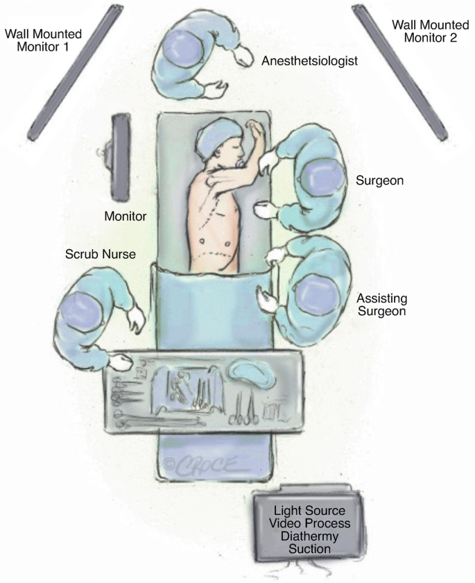 An illustration of the anterior approach depicts the patient on the operating table, the surgeon, assisting surgeon, the scrub nurse, and the anesthesiologist around the table. A monitor is to the patient's left, above him are two wall-mounted monitors, and the light source video process diathermy suction is below.