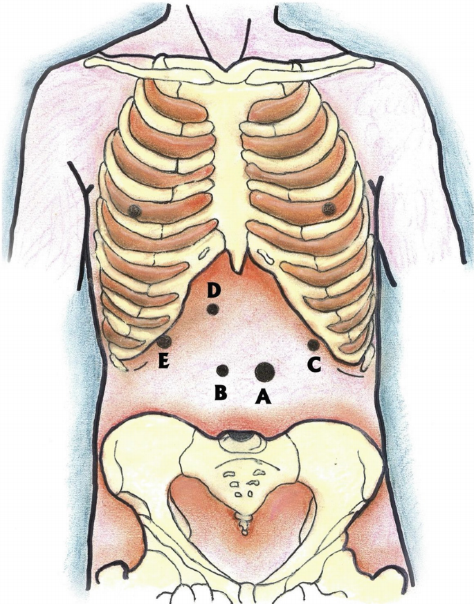 An illustration of the upper human anatomy with emphasis on ribs and pelvis with parts, labeled A, B, C, D, and E.