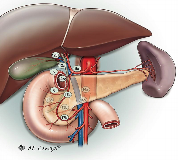 An illustration depicts the pancreas, liver, gall bladder, certain arteries, and sites of common lymphadenectomy.