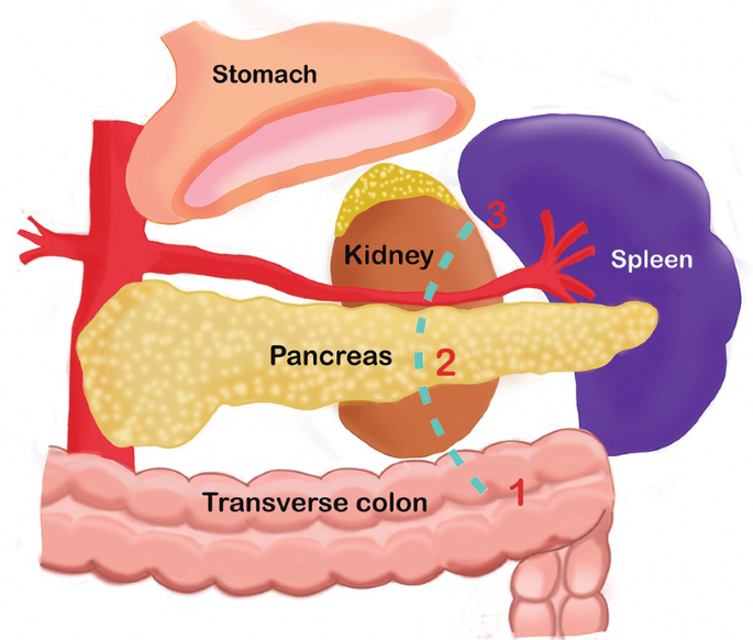 The sketch of body organs such as stomach, pancreas, spleen, kidney, and transverse colon.