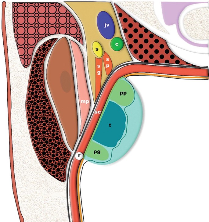 An illustration of the location of the palatal tonsil. The other parts that surround it are marked as j v, s, c, s g, s p, p p, p g, s c, r, and m p. p p, t, and p g are highlighted.