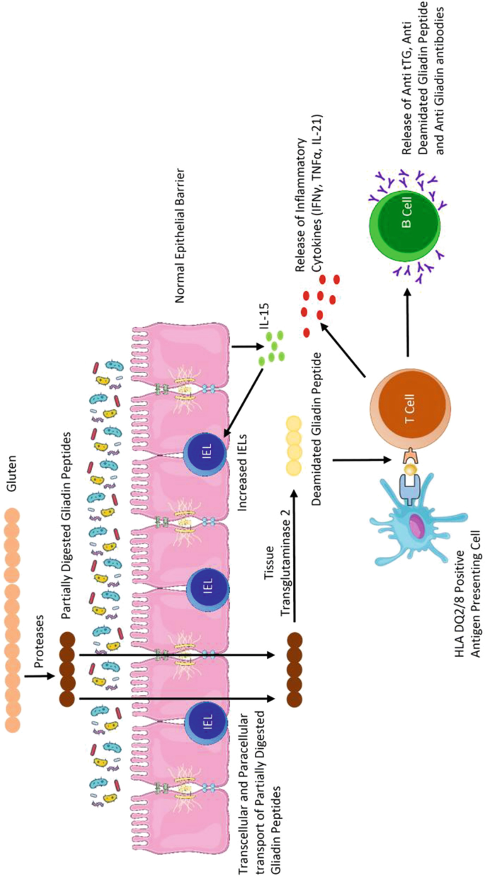 The process involves gluten, partially digested gliadin peptides, normal epithelial barrier, transglutaminase 2, T cell, B cell and others.