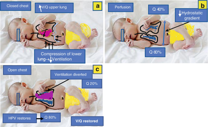 Propofol use in newborns and children: is it safe? A systematic review