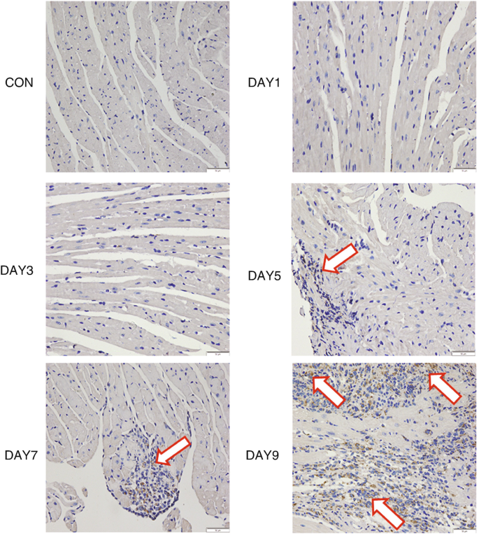 Six images depict immunohistochemical staining containing infiltration of macrophages and N K cells for C O N, days 1, 3, 5, 7, and 9. It is indicated on days 5, 7, and 9.