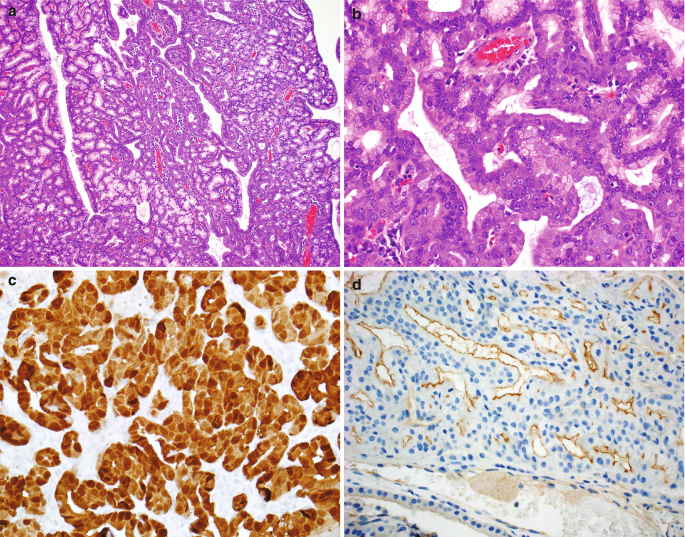 4 microscopic images with 2 purple, brown, and blue staining illustrate cellular and intercellular spaces. The nucleoli are distinct and darkly stained.