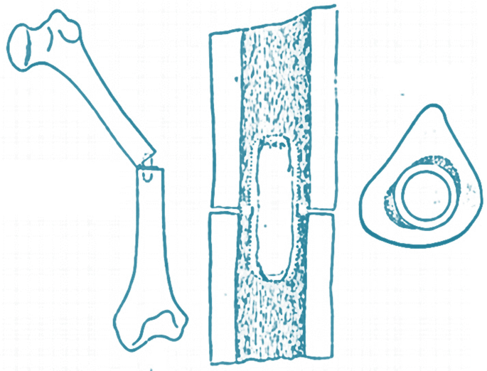 Nail Finger Anatomy Stock Illustration - Download Image Now - Fingernail,  Anatomy, Cuticle - iStock