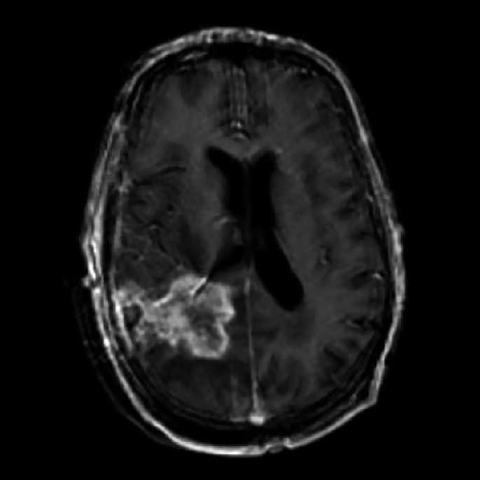 A photograph encompasses an M R I scan of the brain.