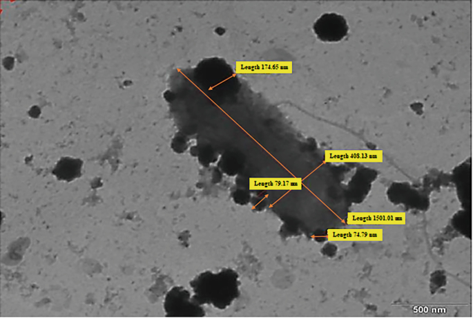 A TEM of Parburkholderia megapolitana species M G T 9 in the scale of 500 nanometers. The species has a rod-shaped structure with measurements marked on it.